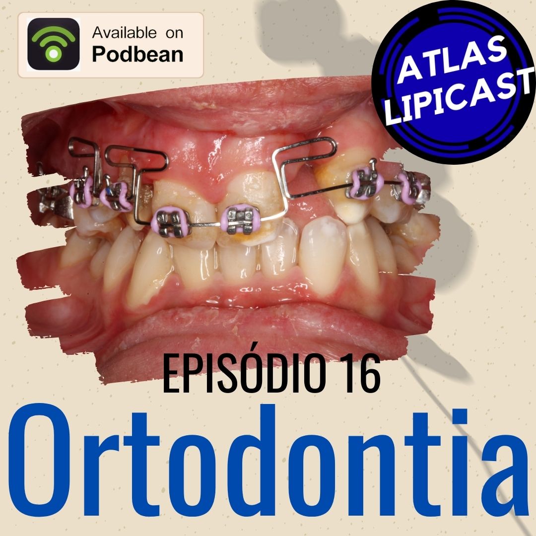 Aparelhos Dentários Do Sevla à Ortodontia Atlaslipicast 3091